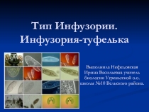 Презентация к уроку биологии в 7 классе по теме : Тип Инфузории