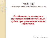 Особенности методики постановки искусственных зубов при различных видах прикусов