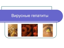 Презентация для классного часа по здоровому образу жизни, тема Вирусные гепатиты