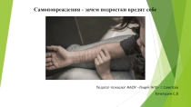 Презентация для учащихся 9-ых классов. Самоповреждение среди подростков.
