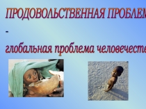 Презентация по географии для 10-11 класса Глобальные проблемы человечества. Продовольственная проблема