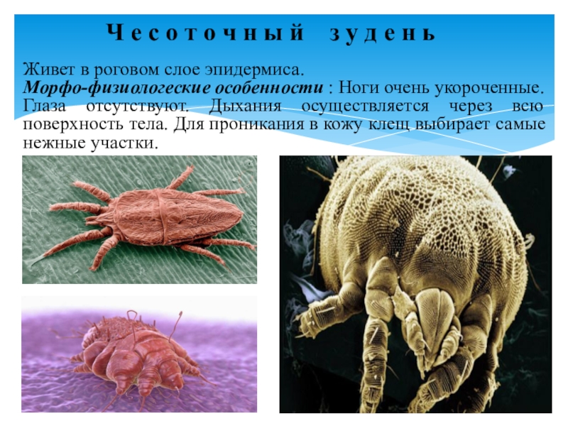 Презентация по микробиологии Медицинская арахноэнтомология. Членистоногие как переносчики возбудителей инфекций и инвазионных заболеваний человека Ч е с о т о ч н ы й з Ч е с о т о ч н ы й з у д е н ьЖивет