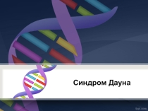 Презентация по генетике на тему Синдром Дауна