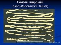 Презентация по ОП. 04 Медицинская паразитология на тему Широкий лентец