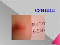 Презентация выступления психолога на родительском собрании на тему профилактика суицида