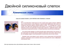 Презентация для зубных техников Двойной силиконовый слепок
