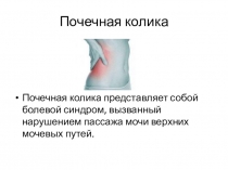 ПРЕЗЕНТАЦИЯ ПОЧЕЧНАЯ КОЛИКА (ДЛЯ СТУДЕНТОВ И ПРЕПОДАВАТЕЛЕЙ МЕДИЦИНСКОГО КОЛЛЕДЖА)