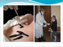 Проектная работа по окружающему миру на тему Полезные свойства пиявок