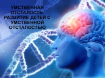 Умственная отсталость, развитие детей с умственной отсталостью