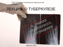 Презентация для классного часа?Туберкулез