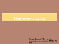 Презентация по теме : Нарушение слуха
