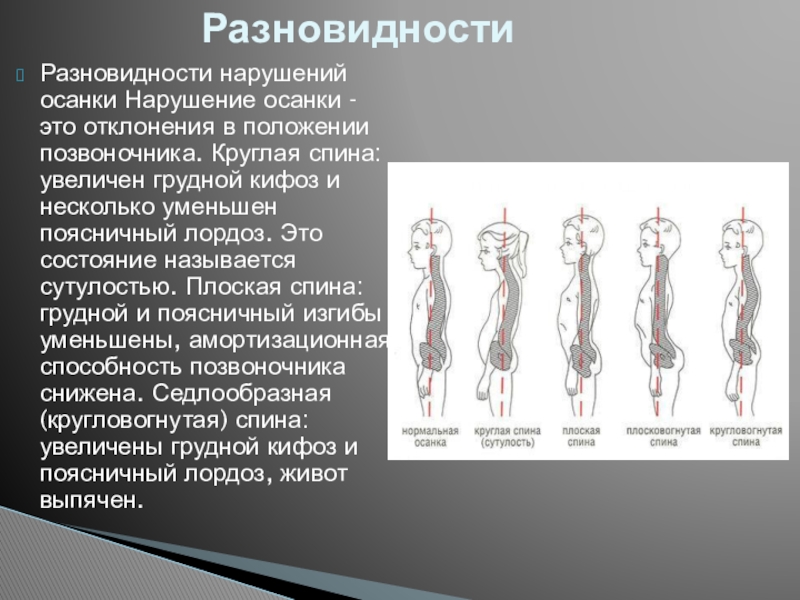 Вертикальное положение позвоночника