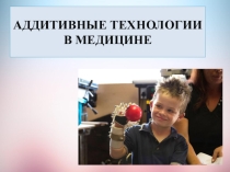 Презентация Аддитивные технологии в медицине