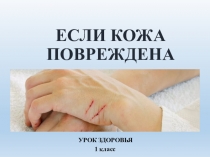 Презентация Если кожа повреждена (урок здоровья, 1 класс)