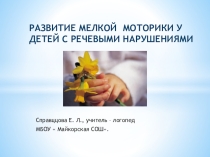 Развитие мелкой моторики у детей с речевыми нарушениями