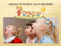 Виды речевых нарушений у детей