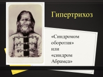 Творческая работа по биологии ученицы 9 класса Грязных Надежды по теме: Гипертрихоз. Генные мутации