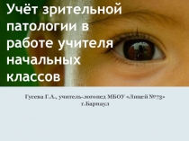 Учёт зрительной патологии учащихся
