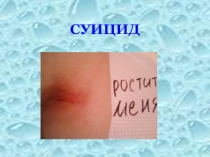 Презентация к докладу Профилактика суицида