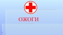 Презентация по ОБЖ на тему Ожоги (6 класс)