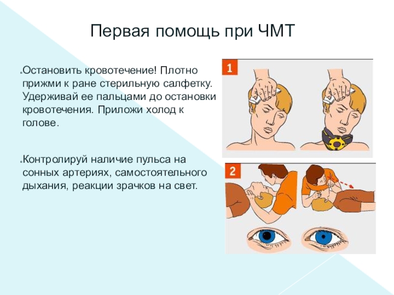 Первая помощь при черепно мозговой травме презентация