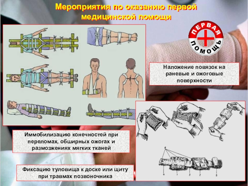 Наложение повязок при различных ранениях