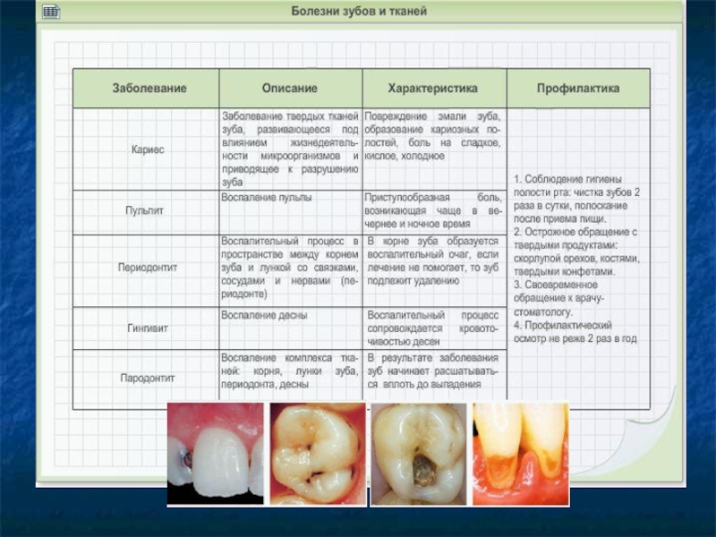 Анализы ротовой полости. Заболевание зубов таблица. Таблица по заболевания зубов.