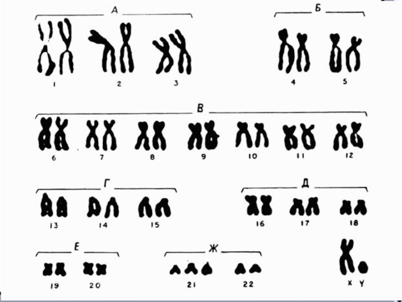 5 заболеваний хромосом. Хромосомная карта кариотип. Кариотип хромосомные болезни человека 10 класс. Кариотип человека хромосомная карта. Патологии кариотипа человека.