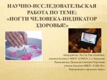 Презентация к научно -исследовательской работе Ногти человека-индикатор здоровья