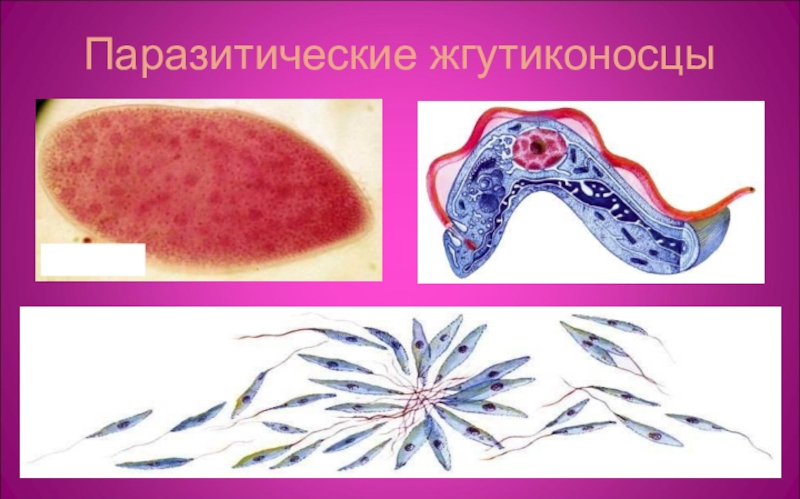 Представителей паразитических. Паразитические жгутиковые лейшмании. Жгутиковые трипаносомы лейшмании. Паразитические жгутиконосцы. Жгутиконосцы паразиты.