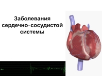 Презентация по биологии на тему Заболевания сердечно-сосудистой системы