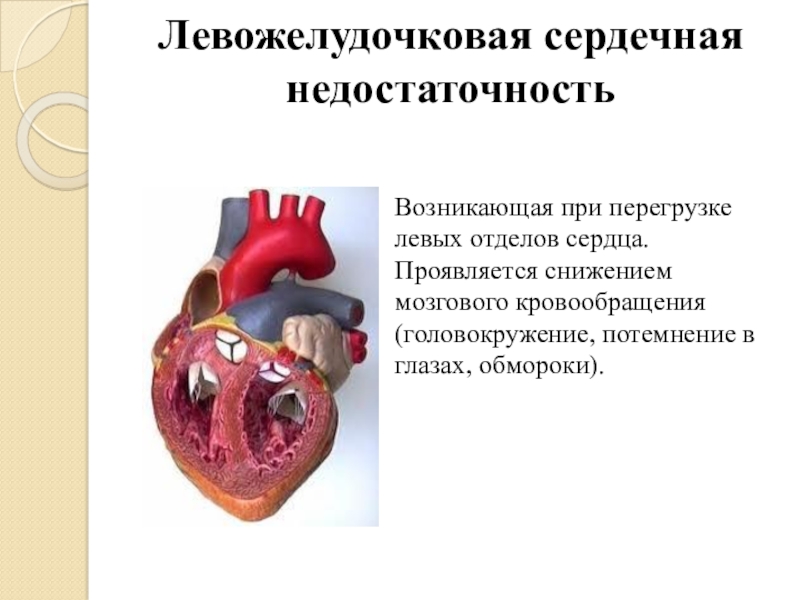 Преимущественное поражение сердца без сердечной недостаточности. Левожелудочковая сердечная недостаточность. Перегрузка левых отделов сердца. Левожелудочковая недостаточность тоны сердца. Поражение левых отделов сердца.