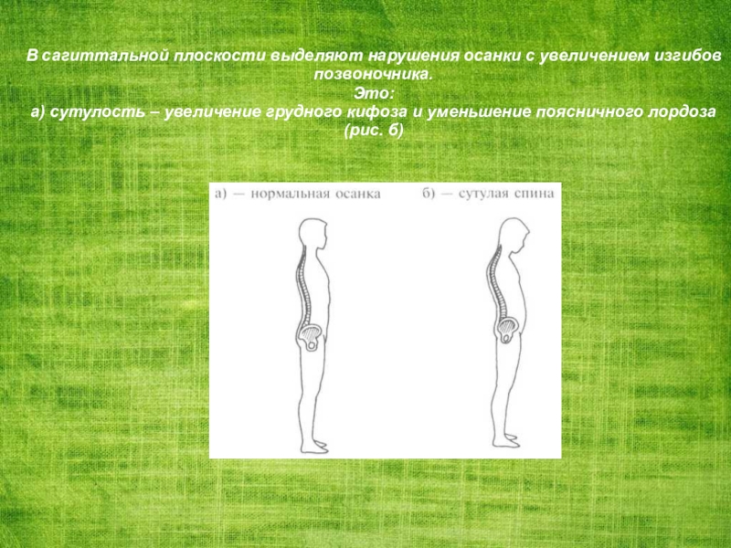 Карта рейтинга осанки хоули и френкс