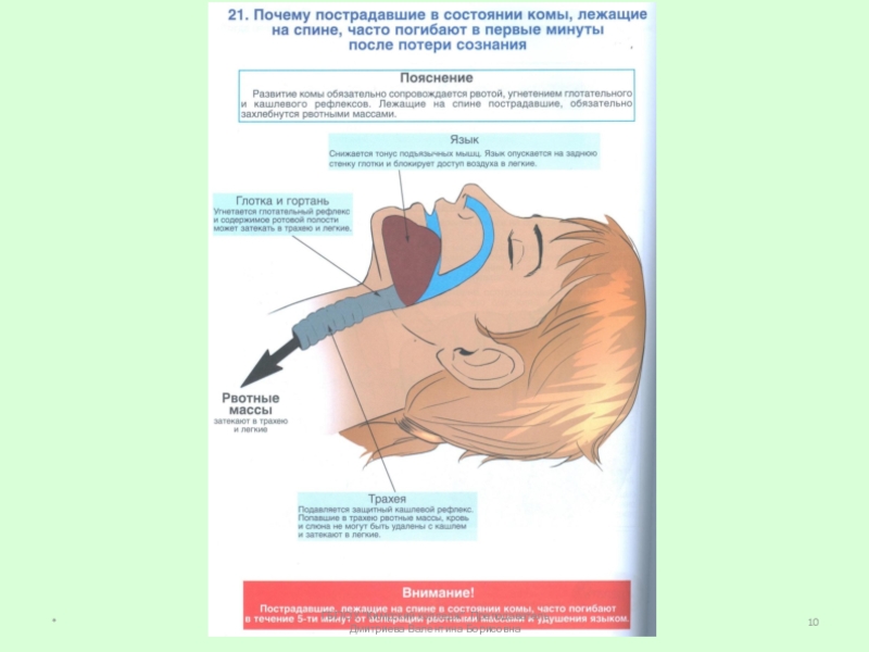 Положение в состоянии комы. Положение пострадавшего в состоянии комы. Экстренная помощь пострадавшего в состоянии комы. Алгоритм оказания первой доврачебной помощи при дтп. Положения при первой помощи.