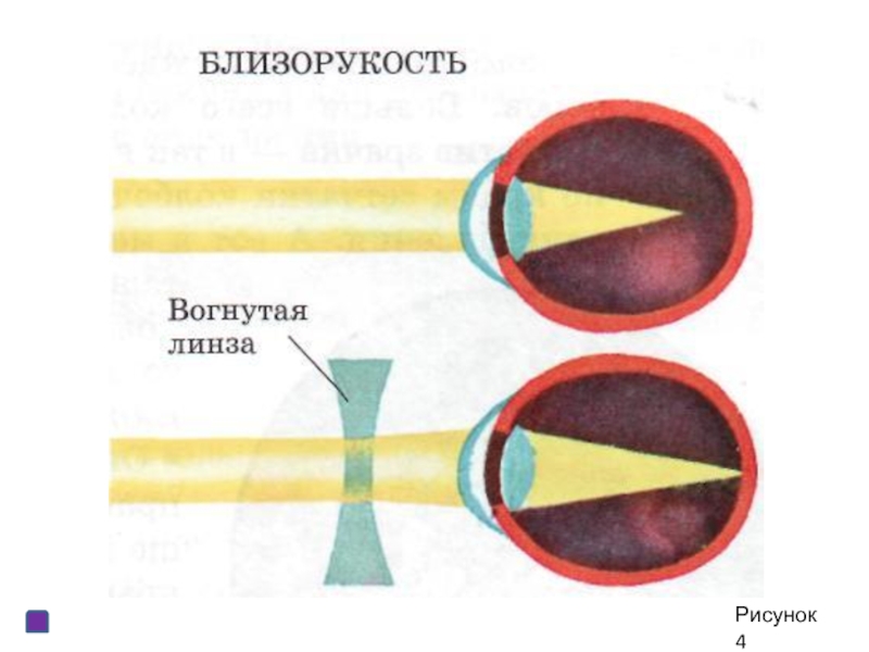 Презентация на тему зрительный анализатор 8 класс биология