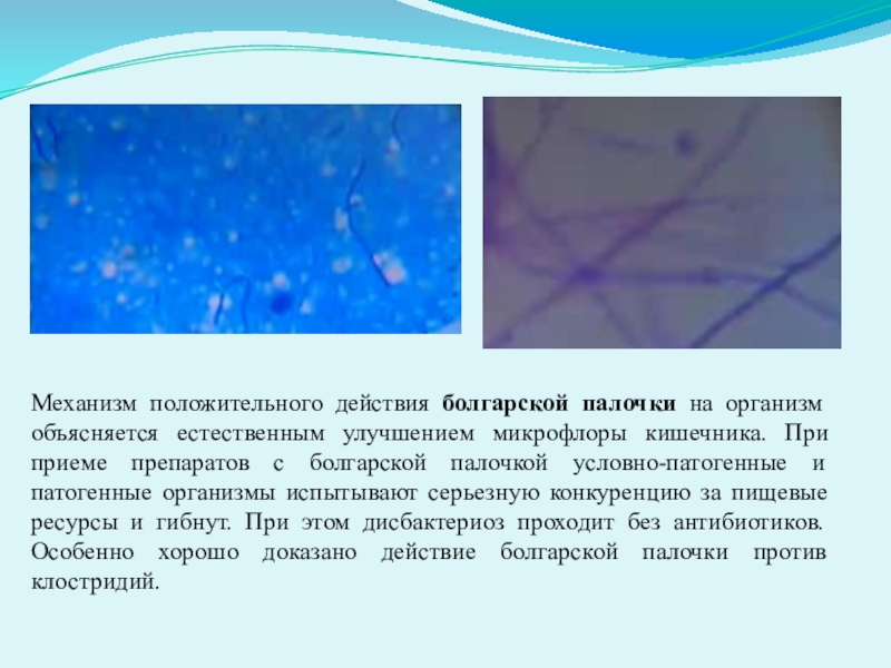 Конкурс проектных и творческих работ обучающихся образовательных учреждений Западного учебного округа Наука и техника 100 лет назад Механизм положительного действия болгарской палочки на организм объясняется естественным улучшением микрофлоры Механизм положительного действия болгарской палочки на организм объясняется естественным улучшением микрофлоры кишечника. При приеме препаратов с болгарской