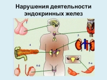 Презентация по биологии Нарушения деятельности эндокринных желез