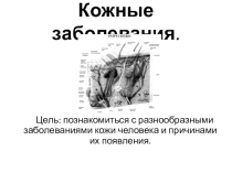 Презентация по биологии на тему Кожные заболевания (8 класс)