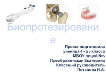 Презентация к проекту на тему: Биопротезирование