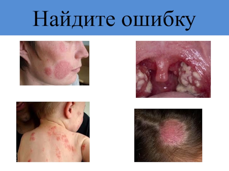 Презентация по фармакологии Антимикозные средства Найдите ошибку Найдите ошибку