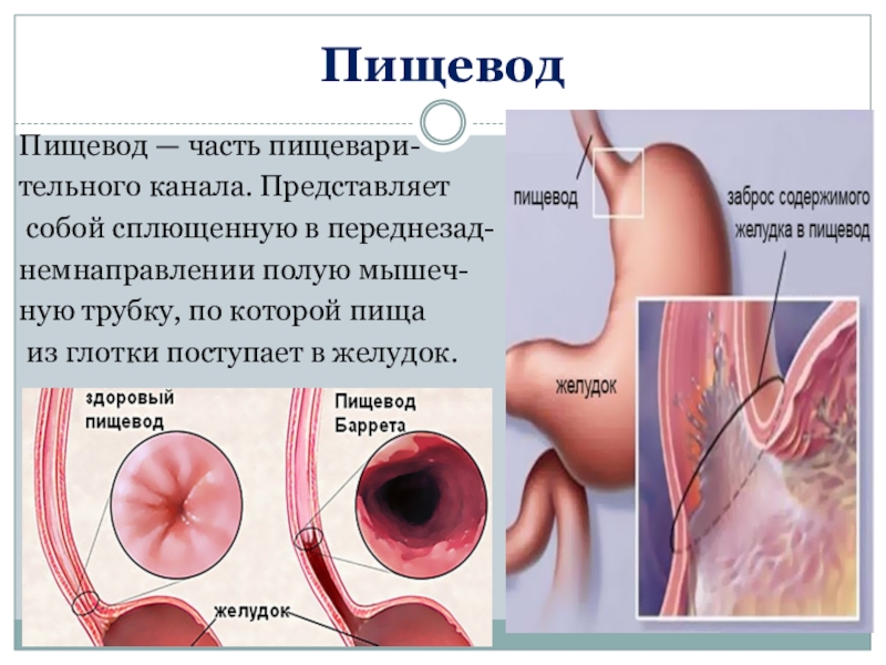 Железы пищевода. Функция желез пищевода. Пищевод Баррета представляет собой.