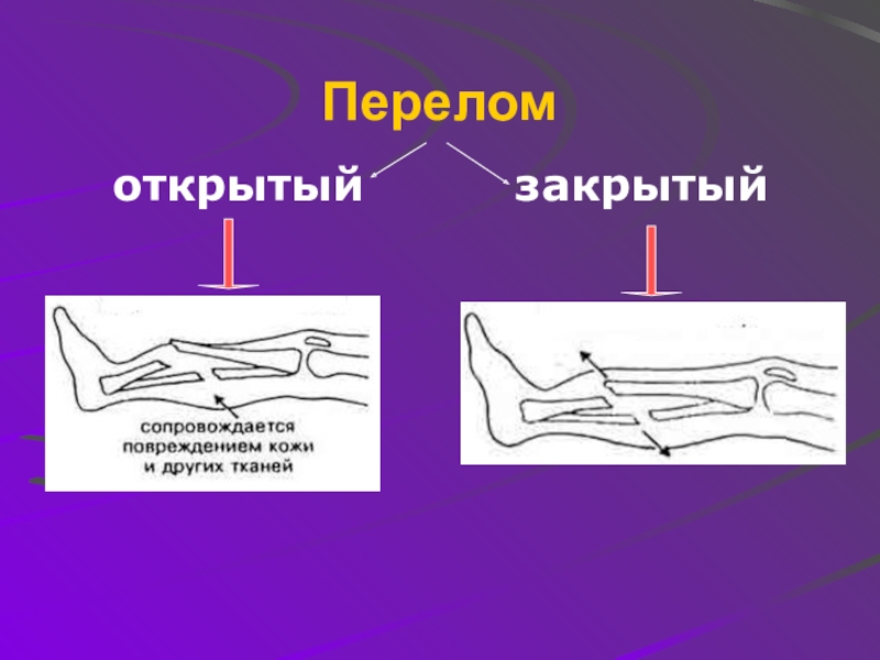 Первая помощь 8 класс биология презентация