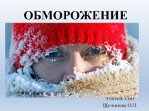 Презентация по СБО Обморожение
